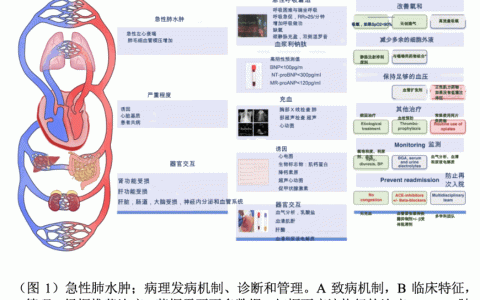 ICU专家处理急性心源性肺水肿时应解决的10个关键问题