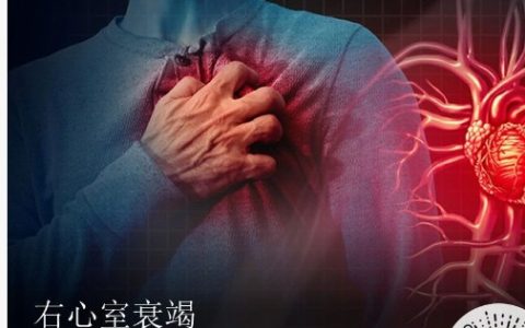 右心室衰竭 |《新英格兰医学杂志》综述