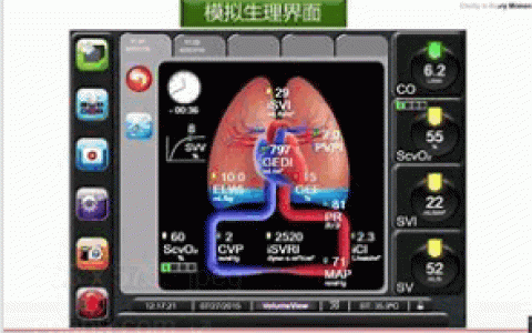 感染性休克血流动力学个体化管理