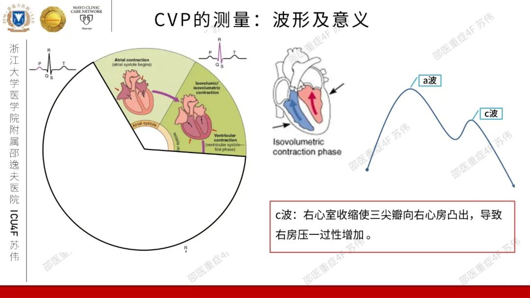 血流动力学系列- 中心静脉压（CVP）