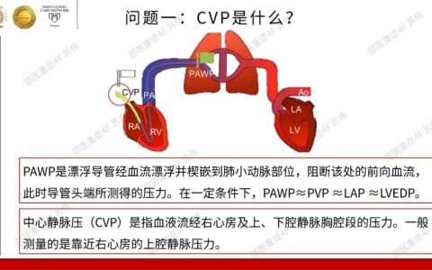 血流动力学系列- 中心静脉压（CVP）