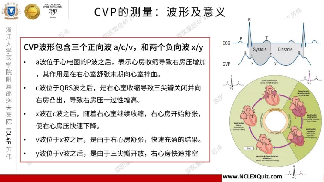 血流动力学系列- 中心静脉压（CVP）