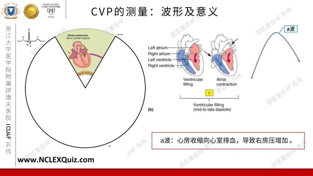 血流动力学系列- 中心静脉压（CVP）