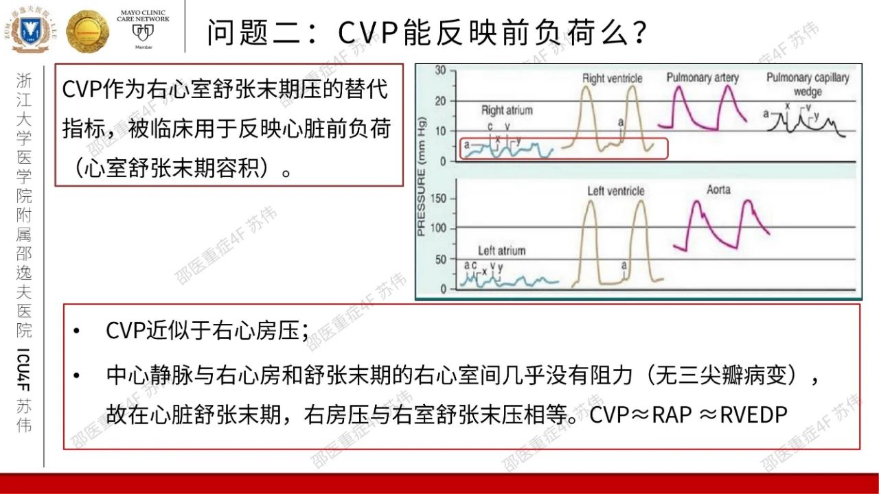 血流动力学系列- 中心静脉压（CVP）
