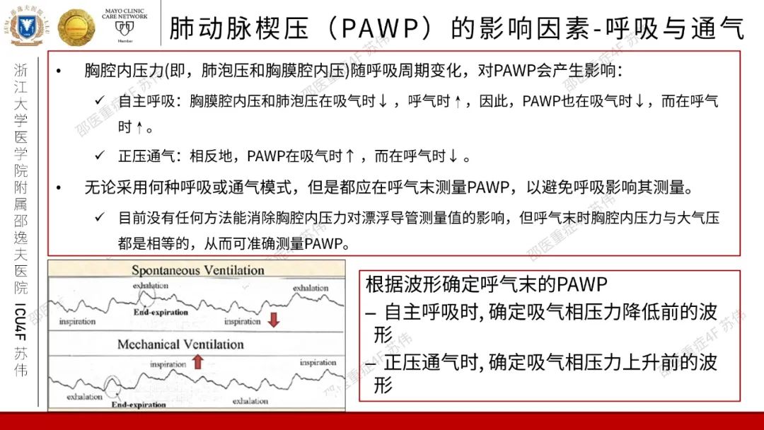 血流动力学系列-肺动脉楔压(PAWP)