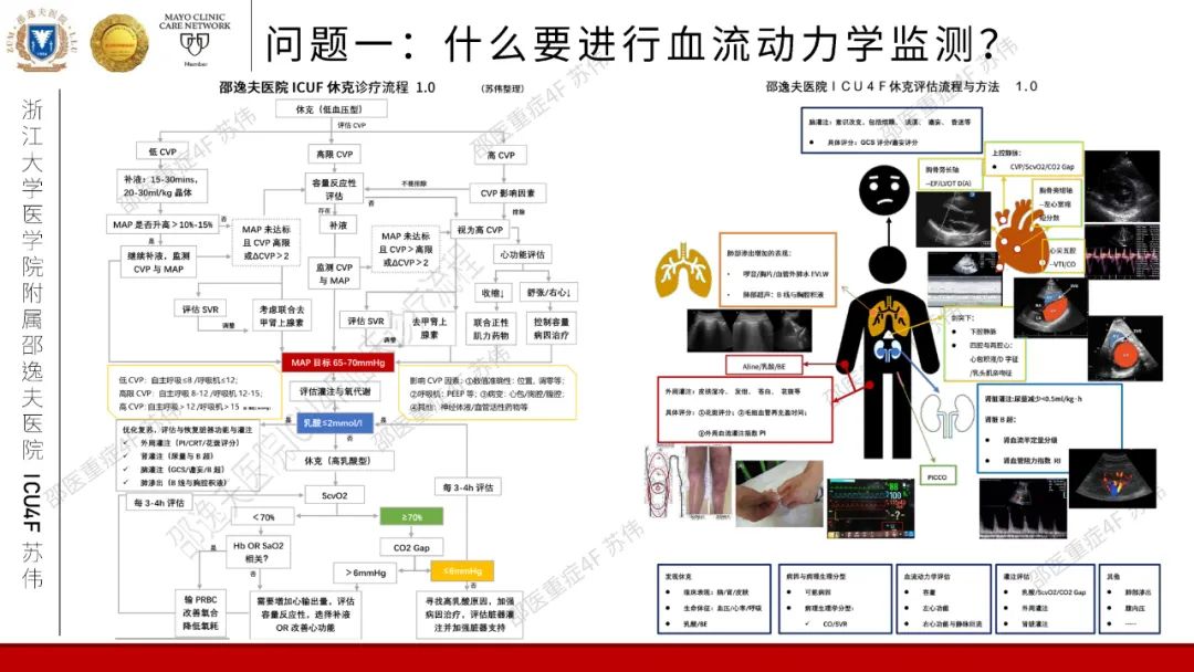 血流动力学系列-肺动脉楔压(PAWP)