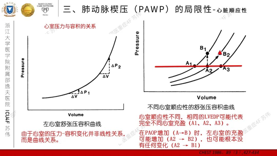 血流动力学系列-肺动脉楔压(PAWP)
