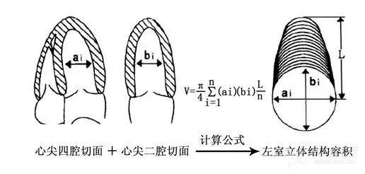 手把手教你解读超声心动图报告单