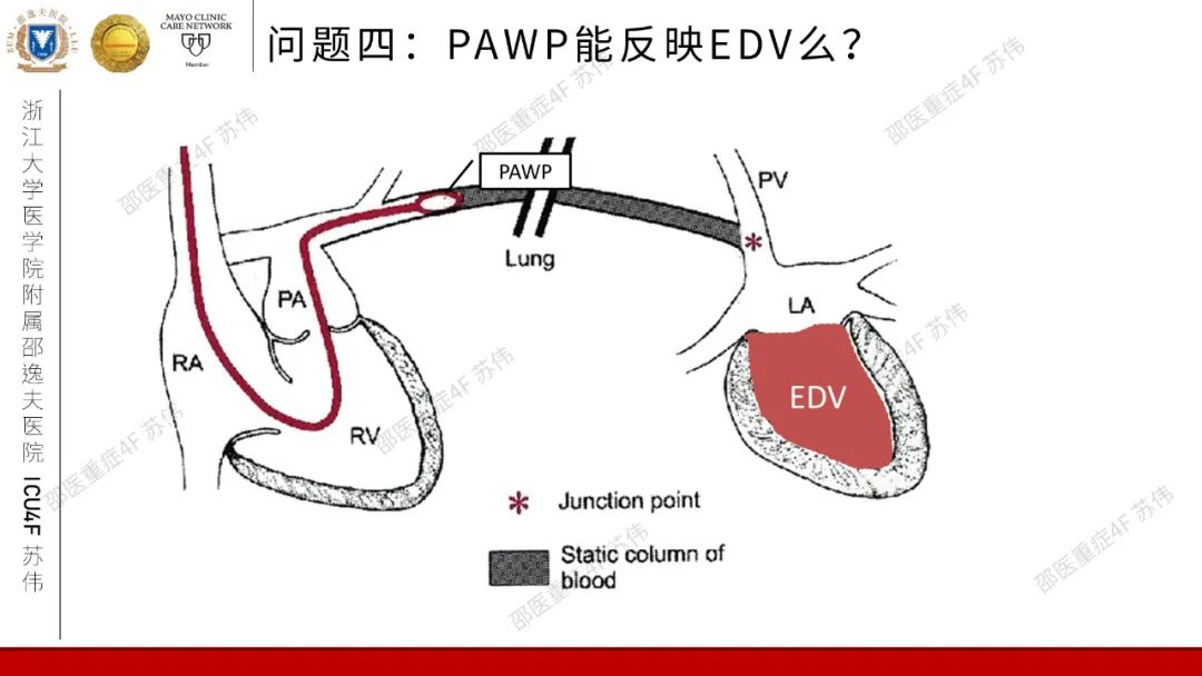 血流动力学系列-肺动脉楔压(PAWP)