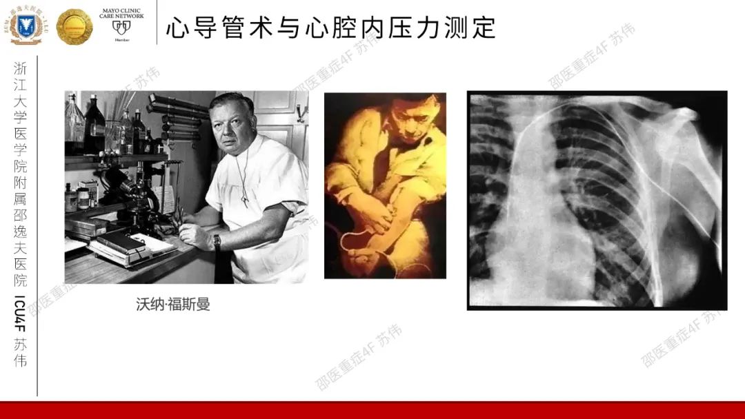血流动力学系列-肺动脉楔压(PAWP)
