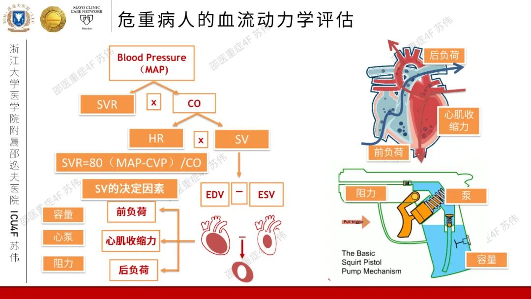 血流动力学系列-肺动脉楔压(PAWP)