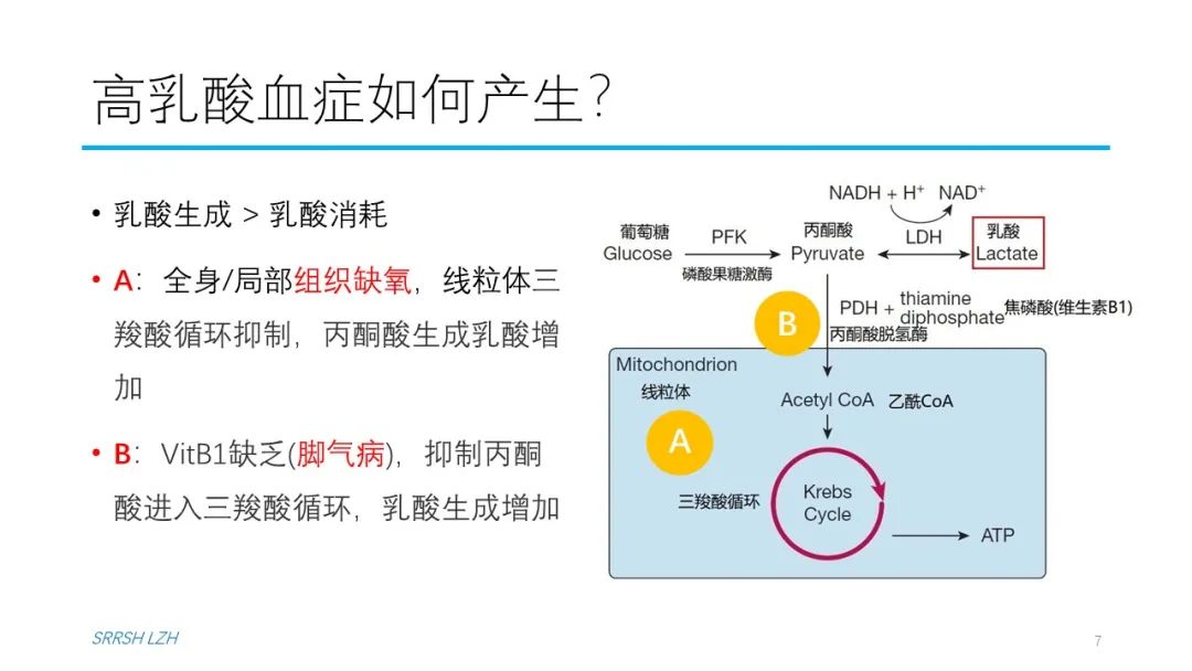 血流动力学系列- 乳酸