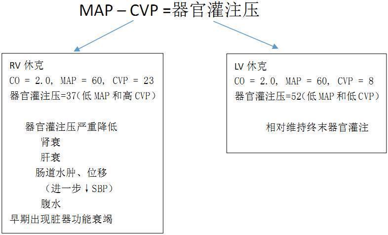 ICU急性右心衰竭的评估与管理