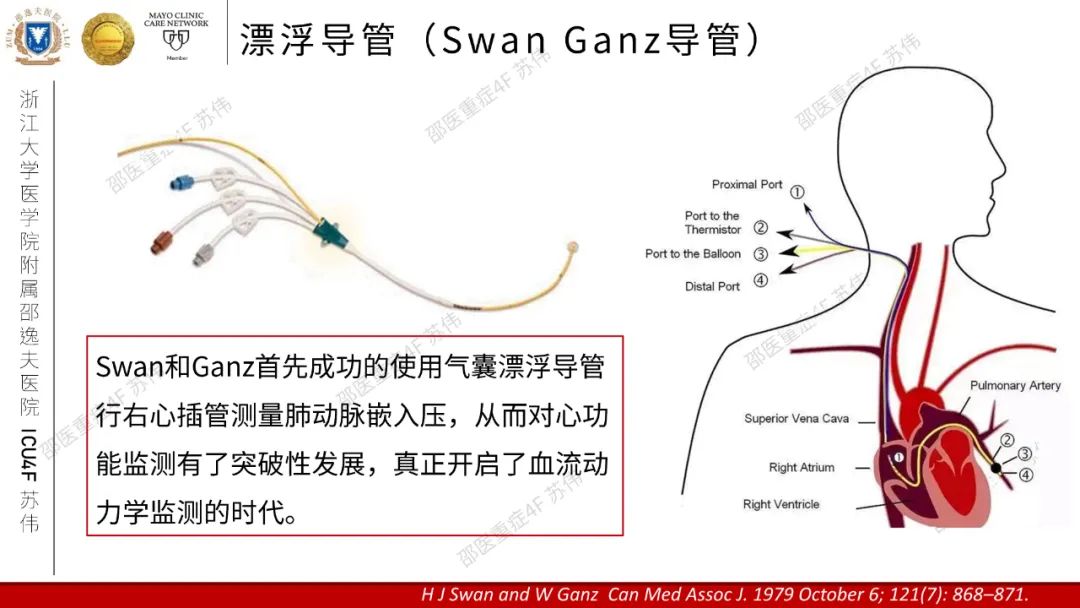 血流动力学系列-肺动脉楔压(PAWP)