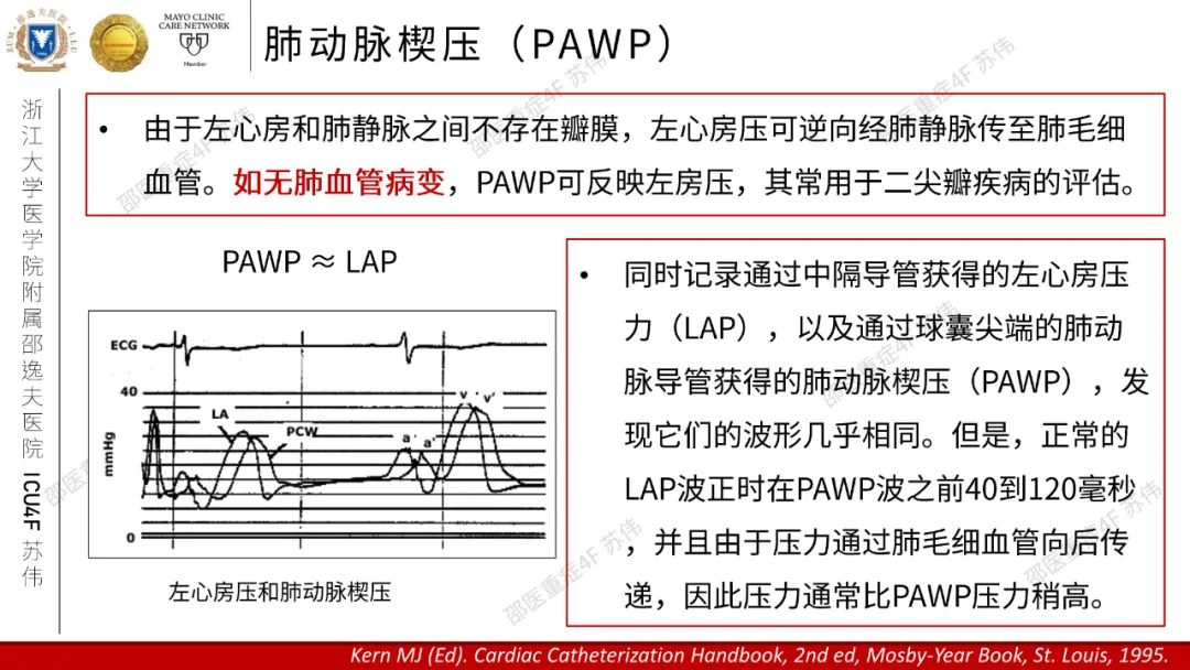 血流动力学系列-肺动脉楔压(PAWP)