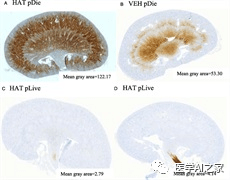 文献学习—机器学习和小鼠模型解释了临床脓毒症试验的失败 文献学习—机器学习和小鼠模型解释了临床脓毒症试验的失败