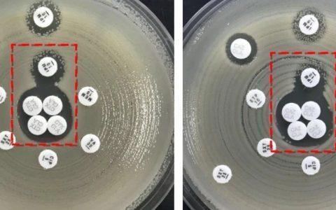 施毅教授：CRO感染的治疗除了替加环素、多黏菌素、思福妥这「三剑客」，还能靠啥？