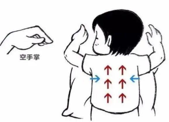 拍背还有这6大禁忌！重症医护人员你知道吗？