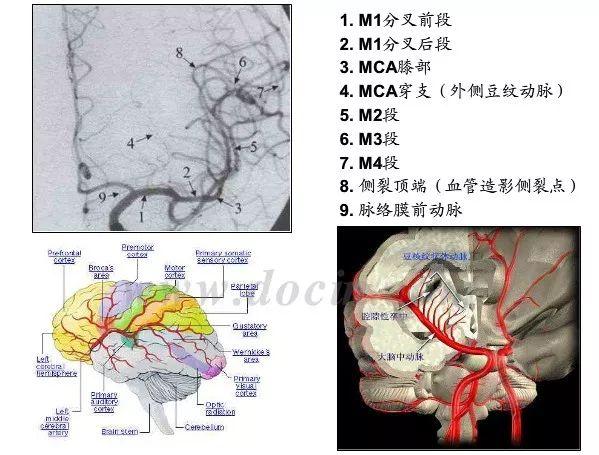 神内影像丨脑血管造影图片详解 神内影像丨脑血管造影图片详解