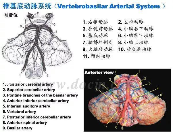神内影像丨脑血管造影图片详解 神内影像丨脑血管造影图片详解