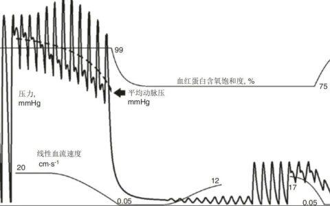 血流动力学基础-血压：生理背景