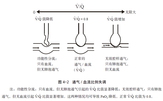 氧分压、血氧饱和度、吸氧浓度、通气功能、换气功能、通气血流比……，这篇文章就够了！