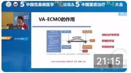 VA-ECMO如何确定撤机时机_詹丽英教授