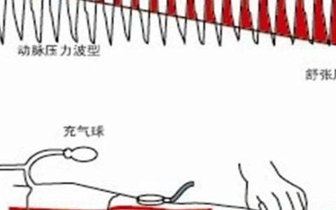 ICU、急诊血流动力学监测，一文总结！