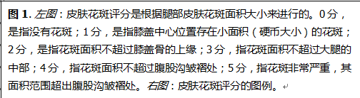 皮肤花斑评分对感染性休克患者的生存预测 皮肤花斑评分对感染性休克患者的生存预测