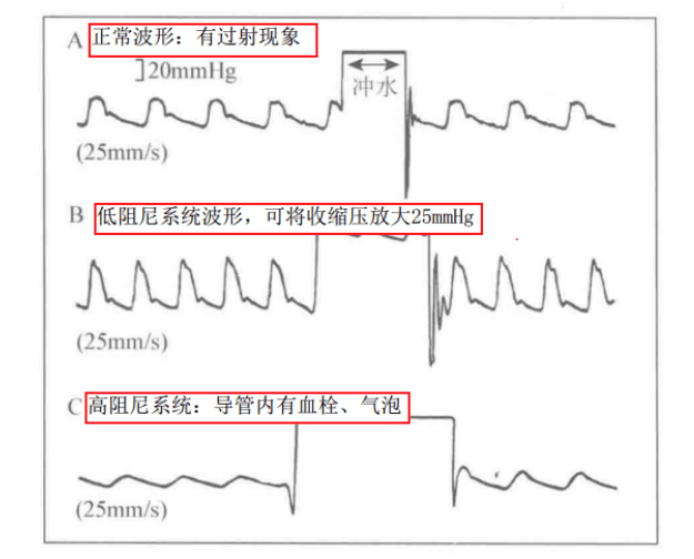 ICU常见图谱【值得收藏】