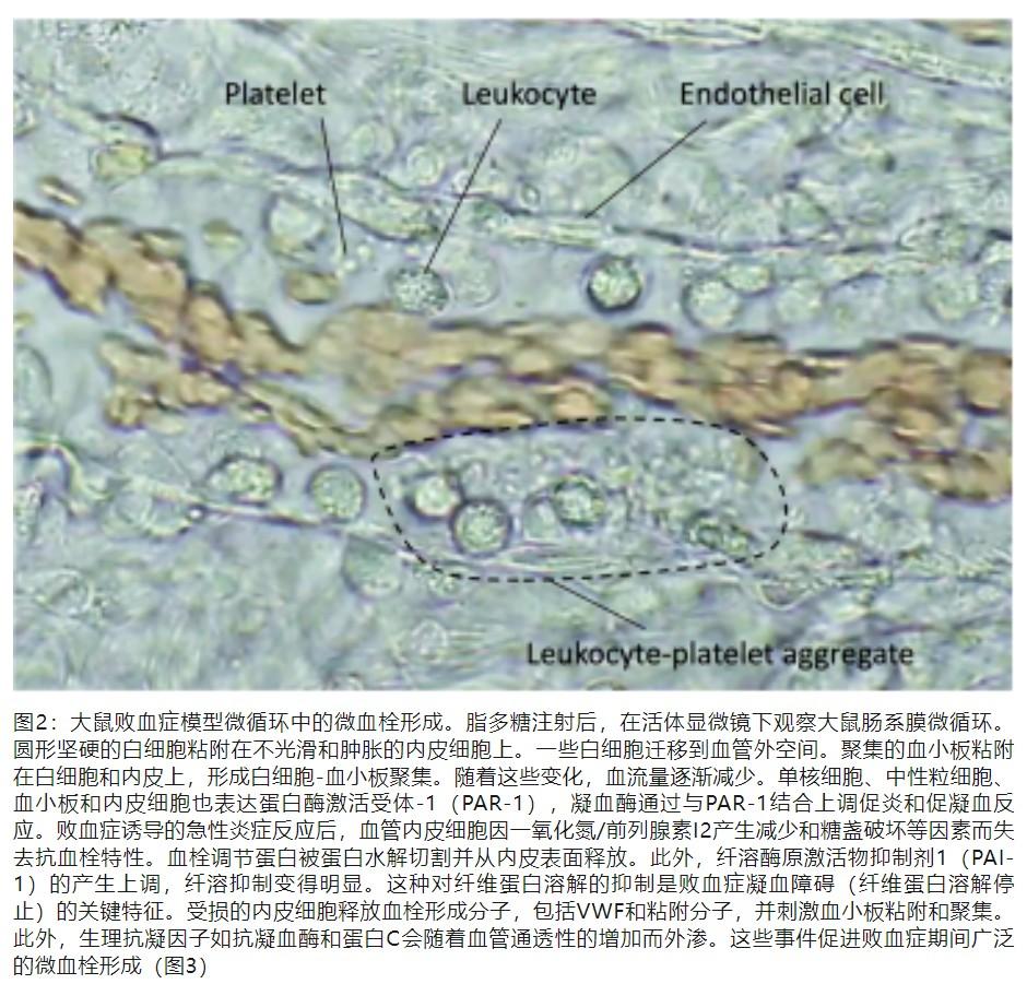 脓毒症相关DIC的病理生理、诊断和治疗