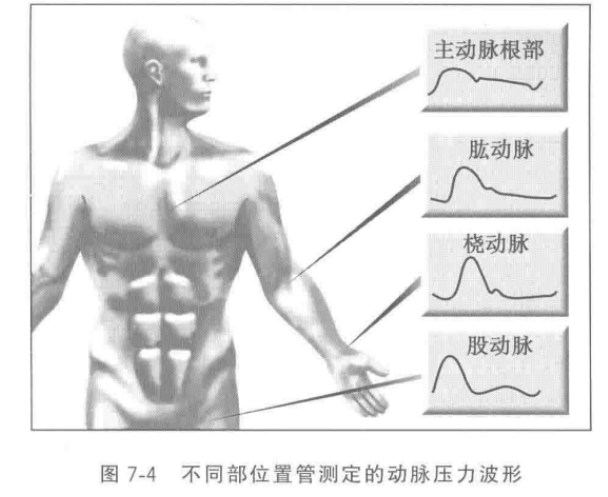 ICU常见图谱【值得收藏】