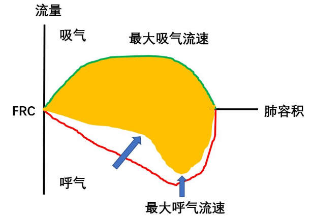 ICU常见图谱【值得收藏】