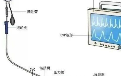 中心静脉压（CVP）