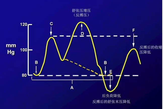 ICU常见图谱【值得收藏】