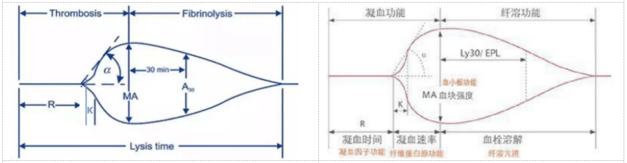轻松读懂血栓弹力图 轻松读懂血栓弹力图