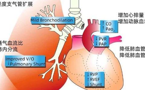 一氧化氮吸入治疗技术