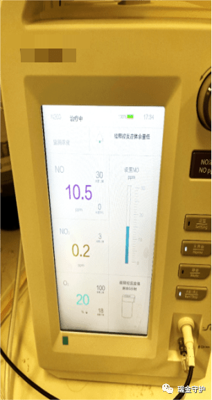 一氧化氮吸入治疗技术