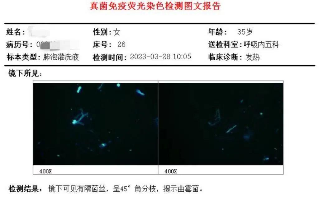 女青年无任何基础病,何因急发高热、呼吸困难?这种难治性或进展性IPA治疗从何入手?丨疑案探密(125) 女青年无任何基础病,何因急发高热、呼吸困难?这种难治性或进展性IPA治疗从何入手?丨疑案探密(125)