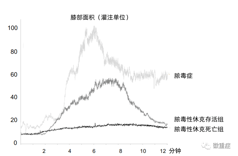 第29期主委话重症:外周组织灌注评估与脓毒性休克 第29期主委话重症:外周组织灌注评估与脓毒性休克