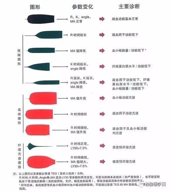 看完这篇总该看得懂血栓弹力图了吧~