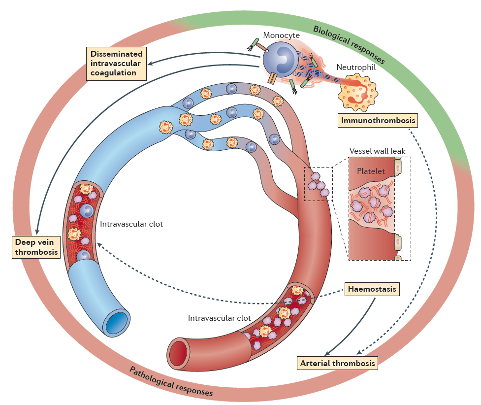 【文献】Nat Rev Immunol综述〡免疫血栓:血管内皮的先天免疫机制 【文献】Nat Rev Immunol综述〡免疫血栓:血管内皮的先天免疫机制
