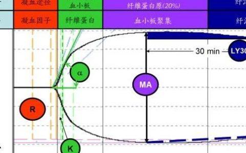 血栓弹力图解读