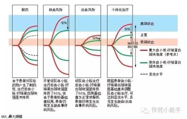 看完这篇总该看得懂血栓弹力图了吧~