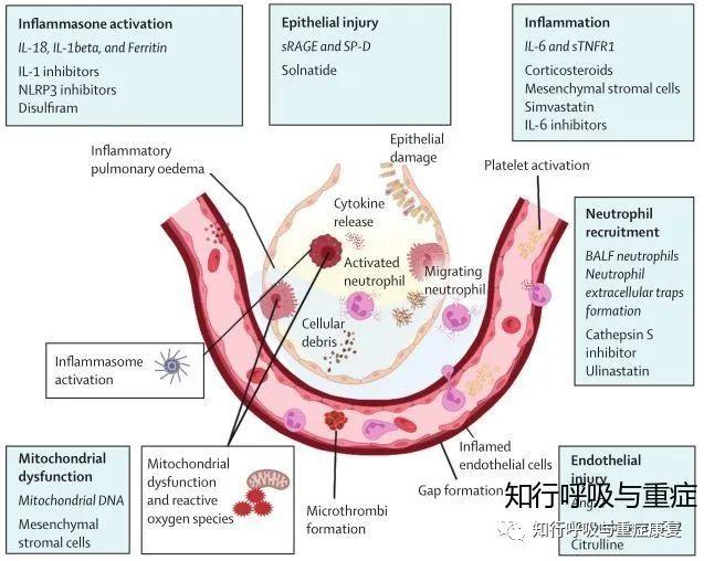 ARDS的诊断、病理生理学及治疗策略