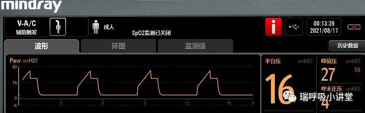 模式相关知识第一讲--平台压等于肺泡压吗? 模式相关知识第一讲--平台压等于肺泡压吗?