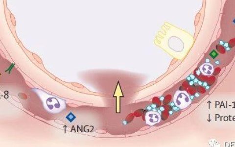急性呼吸窘迫综合征: 病理生理学和表型及临床意义