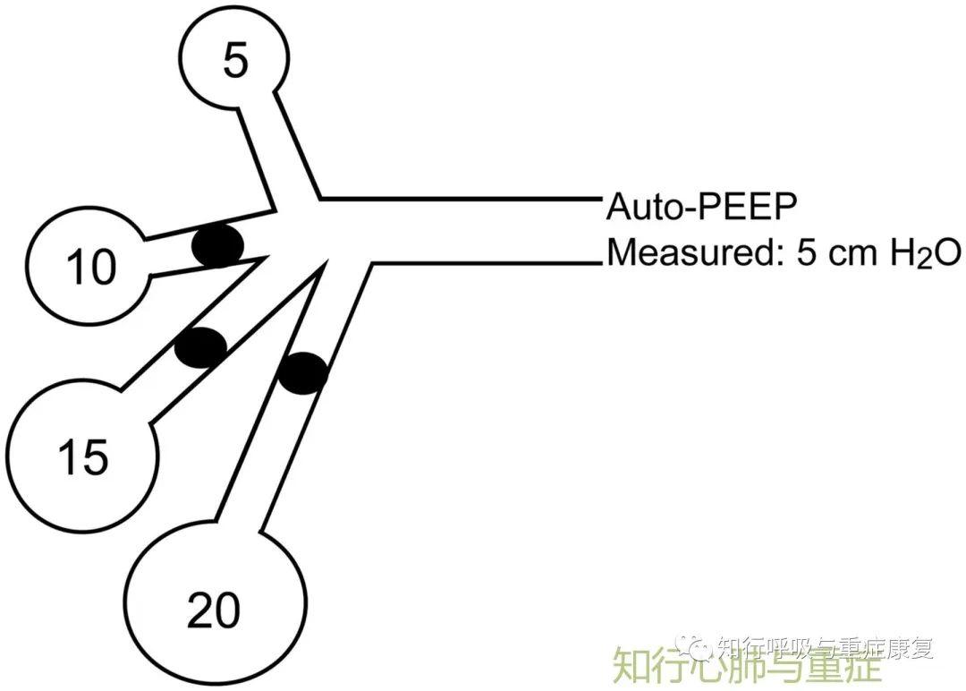 第142期 呼吸力学-从基础到临床 第142期 呼吸力学-从基础到临床