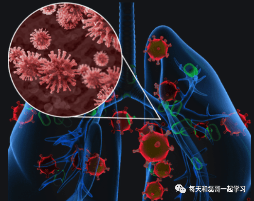 重症疾病之急性呼吸窘迫综合征(三)-ARDS的病因及诱发因素 重症疾病之急性呼吸窘迫综合征(三)-ARDS的病因及诱发因素