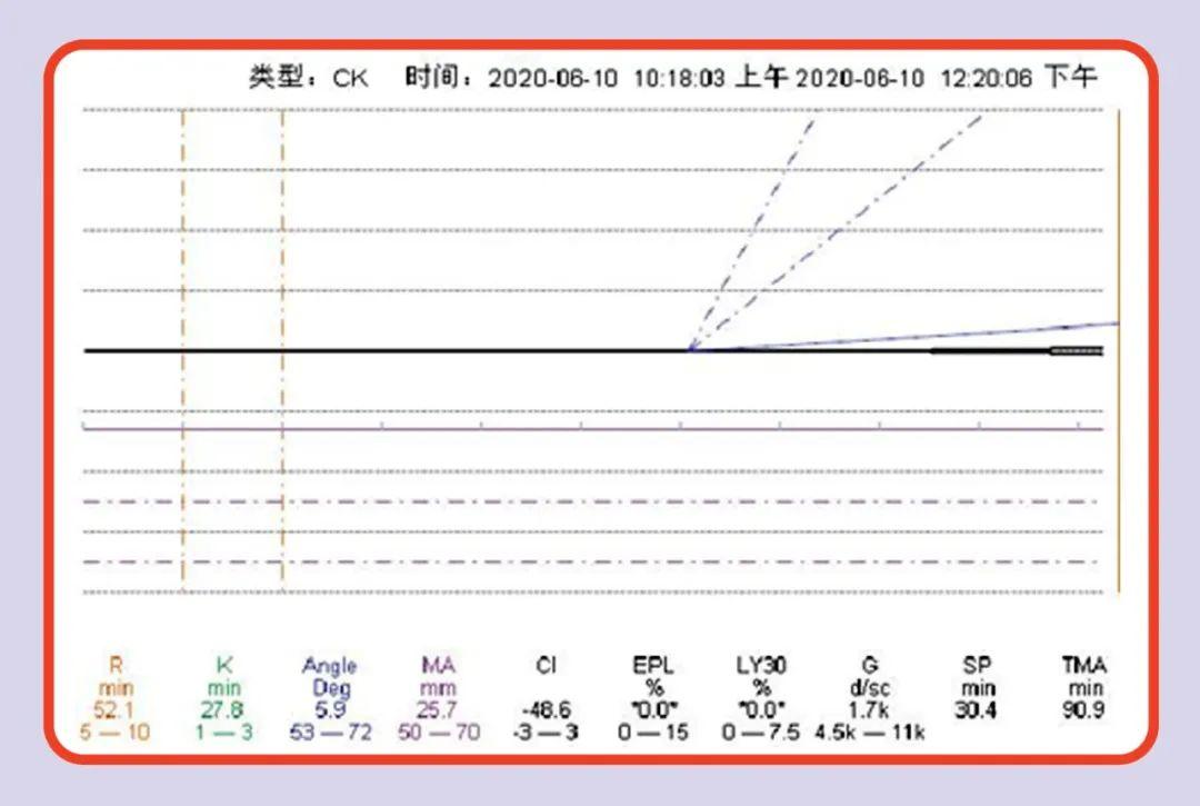 血栓弹力图在脓毒症患者中的应用